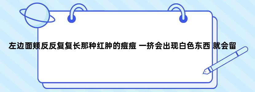 左边面颊反反复复长那种红肿的痘痘 一挤会出现白色东西 就会留坑 怎么治？